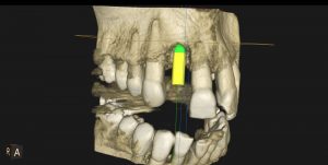 3D Roentgen Sagadent