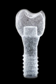 Implantat Implantat Implantologie Sagadent